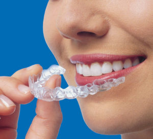 Invisalign® Austin TX 