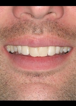 Before Image