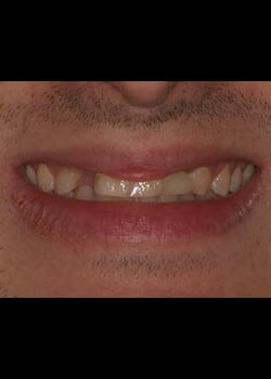 Before Image